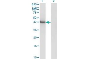 Western Blot analysis of HOXA11 expression in transfected 293T cell line by HOXA11 monoclonal antibody (M05), clone 8B8.