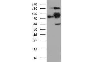 Western Blotting (WB) image for anti-Folate Hydrolase (Prostate-Specific Membrane Antigen) 1 (FOLH1) antibody (ABIN1500455) (PSMA antibody)