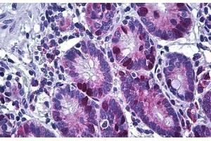 Human Small Intestine: Formalin-Fixed, Paraffin-Embedded (FFPE) (KIFC1 antibody  (AA 53-152))