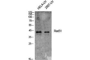 Western Blot (WB) analysis of specific cells using Rad51 Polyclonal Antibody. (RAD51 antibody  (Thr555))