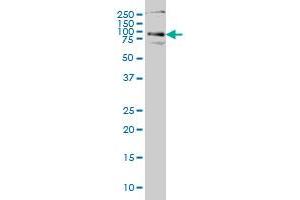 HHIP monoclonal antibody (M01), clone 5D11 Western Blot analysis of HHIP expression in Hela S3 NE . (HHIP antibody  (AA 21-120))