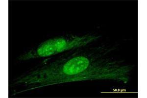 Immunofluorescence of purified MaxPab antibody to ANKRD7 on Hs 181. (ANKRD7 antibody  (AA 1-201))