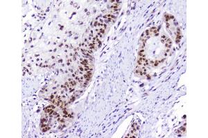 IHC analysis of AHR using anti-AHR antibody (ABIN6719265). (Aryl Hydrocarbon Receptor antibody)