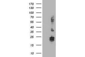HEK293T cells were transfected with the pCMV6-ENTRY control (Left lane) or pCMV6-ENTRY FGF21 (Right lane) cDNA for 48 hrs and lysed. (FGF21 antibody  (AA 29-209))