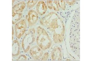 Immunohistochemistry of paraffin-embedded human kidney tissue using ABIN7163421 at dilution of 1:100 (PSPH antibody  (AA 1-225))