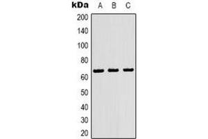 Western blot analysis of NF-kappaB p65 expression in Hela (A), 293T (B), HepG (C) whole cell lysates. (NF-kB p65 antibody)