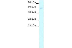WB Suggested Anti-TRIM15 Antibody Titration:  1. (TRIM15 antibody  (N-Term))