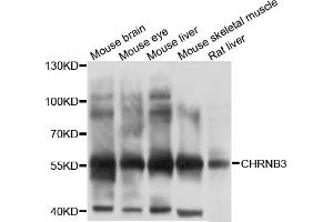 Western blot analysis of extracts of various cell lines, using CHRNB3 antibody (ABIN4903288) at 1:1000 dilution. (CHRNB3 antibody)