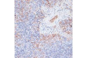 Immunohistochemistry of paraffin-embedded mouse spleen using Cathepsin G antibody (ABIN6127686, ABIN6139228, ABIN6139230 and ABIN6217069) at dilution of 1:100 (40x lens). (Cathepsin G antibody  (AA 75-190))