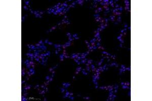 Immunofluorescence of paraffin embedded rat lung using tfiib (ABIN7074034) at dilution of 1: 500 (300x lens)