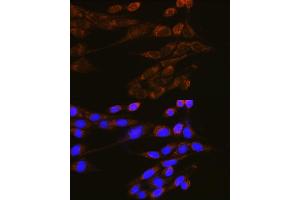 Immunofluorescence analysis of NIH-3T3 cells using DNM2 Rabbit pAb (ABIN6127773, ABIN6139741, ABIN6139742 and ABIN6223876) at dilution of 1:100 (40x lens). (DNM2 antibody  (AA 607-866))
