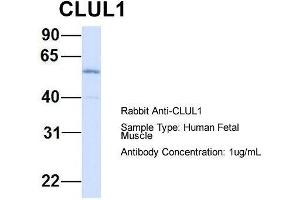 Host: Rabbit  Target Name: CLUL1  Sample Tissue: Human Fetal Muscle  Antibody Dilution: 1. (CLUL1 antibody  (Middle Region))