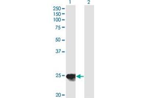 Western Blot analysis of YKT6 expression in transfected 293T cell line by YKT6 monoclonal antibody (M03), clone 1F8. (YKT6 antibody  (AA 99-198))