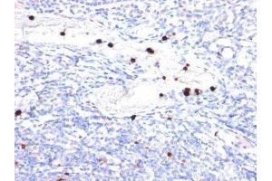 Image no. 1 for anti-Colony Stimulating Factor 3 (Granulocyte) (CSF3) antibody (ABIN6161622) (G-CSF antibody)