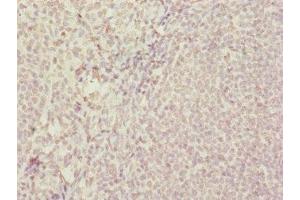 Immunohistochemistry of paraffin-embedded human tonsil tissue using ABIN7172439 at dilution of 1:100 (SUPT4H antibody  (AA 1-117))