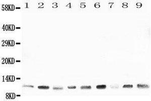 Western Blotting (WB) image for anti-Heat Shock 10kDa Protein 1 (Chaperonin 10) (HSPE1) (AA 81-102), (C-Term) antibody (ABIN3044176) (HSPE1 antibody  (C-Term))