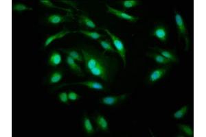 Immunofluorescence staining of Hela cells with ABIN7142198 at 1:200, counter-stained with DAPI. (PSMD1 antibody  (Regulatory Subunit 10))