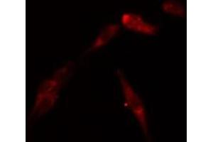 ABIN6269198 staining Hela by IF/ICC. (CDK2 antibody  (Internal Region))