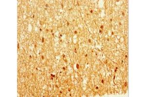 Immunohistochemistry of paraffin-embedded human brain tissue using ABIN7157846 at dilution of 1:100 (EPM2A antibody  (Isoform 9))