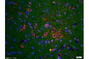 Formalin-fixed and paraffin embedded rat brain labeled with Rabbit Anti Phospho-Troponin I(Ser23/24) Polyclonal Antibody, Unconjugated (ABIN746633) at 1:200 followed by conjugation to the secondary antibody and DAB staining (Troponin I antibody  (pSer23, pSer24))