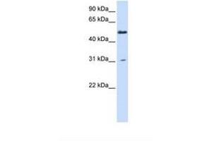 Image no. 1 for anti-Alanine-Glyoxylate Aminotransferase 2-Like 2 (AGXT2L2) (AA 74-123) antibody (ABIN6738402) (AGXT2L2 antibody  (AA 74-123))