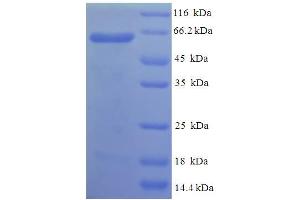 SDS-PAGE (SDS) image for phosphatidylserine Decarboxylase (PISD) (AA 1-375), (Isoform 2) protein (His-SUMO Tag) (ABIN5711877) (PISD Protein (AA 1-375, Isoform 2) (His-SUMO Tag))