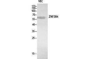 Western Blot (WB) analysis of VEC cells using ZNF384 Polyclonal Antibody.