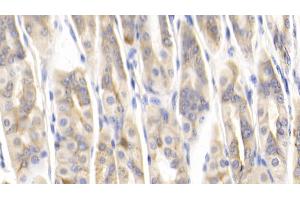 Detection of MCP1 in Mouse Stomach Tissue using Polyclonal Antibody to Monocyte Chemotactic Protein 1 (MCP1) (CCL2 antibody  (AA 24-96))