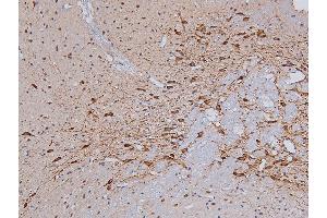 ABIN6267325 at 1/200 staining Rat brain tissue sections by IHC-P. (Tyrosine Hydroxylase antibody  (pSer31))