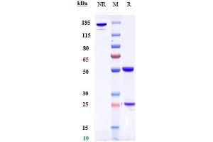 Anti-DLK1 Reference Antibody (LIV-1205) on SDS-PAGE under reducing (R) condition.