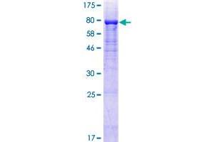 Image no. 1 for Plexin Domain Containing 2 (PLXDC2) (AA 1-480) protein (GST tag) (ABIN1315491)