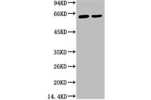 Western blot analysis of 1) Hela, 2) HepG2, diluted at 1:2000. (KRT6A antibody)