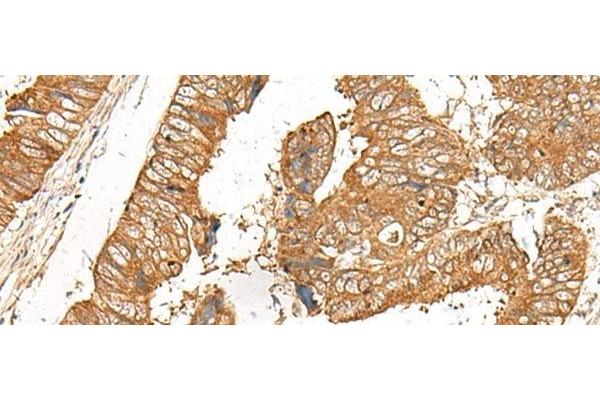 GOLGA6A antibody