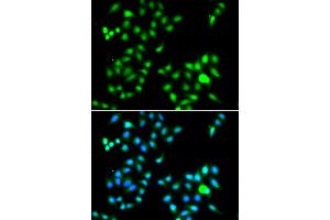 Immunofluorescence analysis of A549 cells using TWIST1 antibody (ABIN4905524).