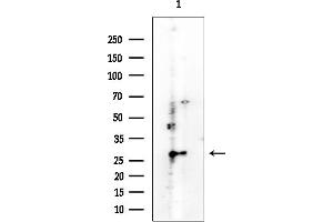 anti-VAMP (Vesicle-Associated Membrane Protein)-Associated Protein A, 33kDa (VAPA) antibody