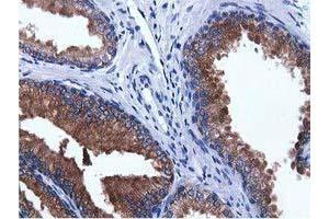 Immunohistochemical staining of paraffin-embedded Human prostate tissue using anti-ADI1 mouse monoclonal antibody. (ADI1 antibody)
