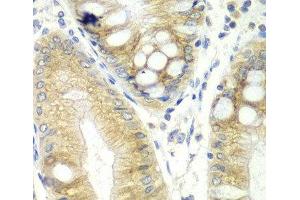 Immunohistochemistry of paraffin-embedded Human colon using CES2 Polyclonal Antibody at dilution of 1:100 (40x lens). (CES2 antibody)