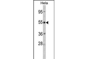 Western blot analysis of CRHR2 Antibody (Center) (ABIN390758 and ABIN2841016) in Hela cell line lysates (35 μg/lane). (CRHR2 antibody  (AA 243-272))