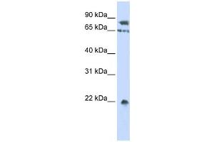 Western Blotting (WB) image for anti-SUMO1/sentrin Specific Peptidase 1 (SENP1) antibody (ABIN2459849) (SENP1 antibody)