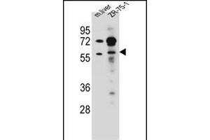 TRIM62 Antibody (C-term) (ABIN657216 and ABIN2837911) western blot analysis in mouse liver tissue and ZR-75-1 cell line lysates (35 μg/lane). (TRIM62 antibody  (C-Term))
