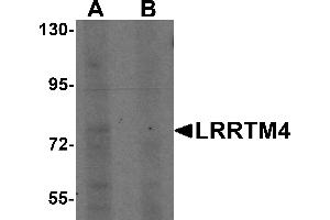 Western Blotting (WB) image for anti-Leucine Rich Repeat Transmembrane Neuronal 4 (LRRTM4) (Middle Region) antibody (ABIN1030989) (LRRTM4 antibody  (Middle Region))