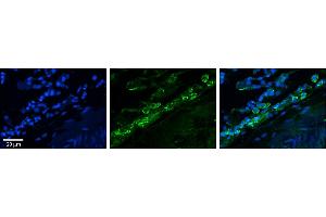 Rabbit Anti-GJA4 Antibody     Formalin Fixed Paraffin Embedded Tissue: Human Lung Tissue  Observed Staining: Membrane in alveolar type I cells and macrophages  Primary Antibody Concentration: 1:100  Other Working Concentrations: 1/600  Secondary Antibody: Donkey anti-Rabbit-Cy3  Secondary Antibody Concentration: 1:200  Magnification: 20X  Exposure Time: 0.