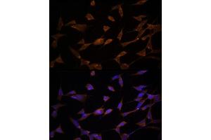 Immunofluorescence analysis of PC-12 cells using [KO Validated] AMPKα2 Rabbit pAb (ABIN6129903, ABIN6146170, ABIN6146172 and ABIN6218273) at dilution of 1:150 (40x lens). (PRKAA2 antibody  (AA 343-552))