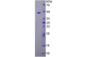 SDS-PAGE (SDS) image for Artemin (ARTN) (AA 108-220) protein (His tag,GST tag) (ABIN6237265)