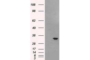 Western Blotting (WB) image for anti-Baculoviral IAP Repeat-Containing 7 (BIRC7) antibody (ABIN1499181) (BIRC7 antibody)