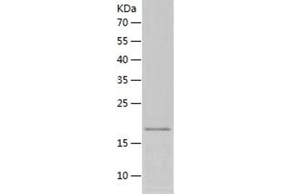 Ectodysplasin A Protein (EDA) (AA 245-391) (His tag)