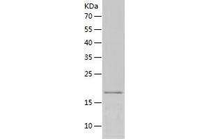 Western Blotting (WB) image for Ectodysplasin A (EDA) (AA 245-391) protein (His tag) (ABIN7122737) (Ectodysplasin A Protein (EDA) (AA 245-391) (His tag))