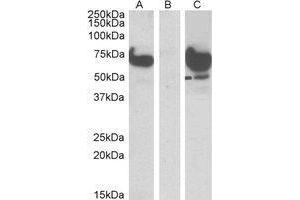 HEK293 lysate (10ug protein in RIPA buffer) overexpressing Human EPM2AIP1 with DYKDDDDK tag probed with AP23768PU-N (1µg/ml) in Lane A and probed with anti-DYKDDDDK Tag (1/1000) in lane C. (EPM2AIP1 antibody  (N-Term))