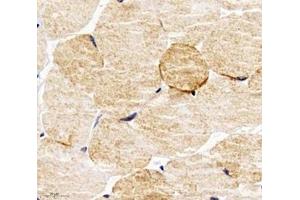 Immunohistochemistry analysis of paraffin-embedded mouse skeletal muscle using PPAPDC3 (ABIN7075036) at dilution of 1: 4000 (PPAPDC3 antibody)