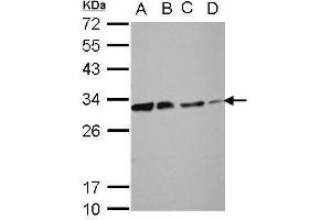 WB Image Sample (30 ug of whole cell lysate) A: 293T B: A431 C: HeLa D: HepG2 12% SDS PAGE antibody diluted at 1:10000 (DCK antibody)